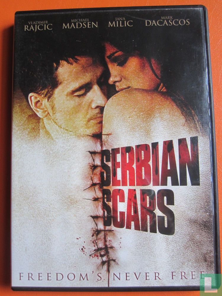 Serbian Scars