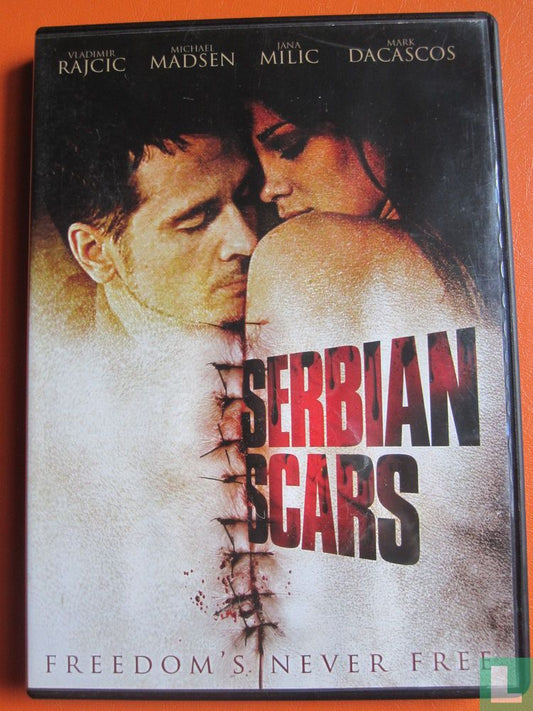Serbian Scars